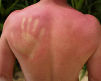 Sunbeds vs. Sunbathing