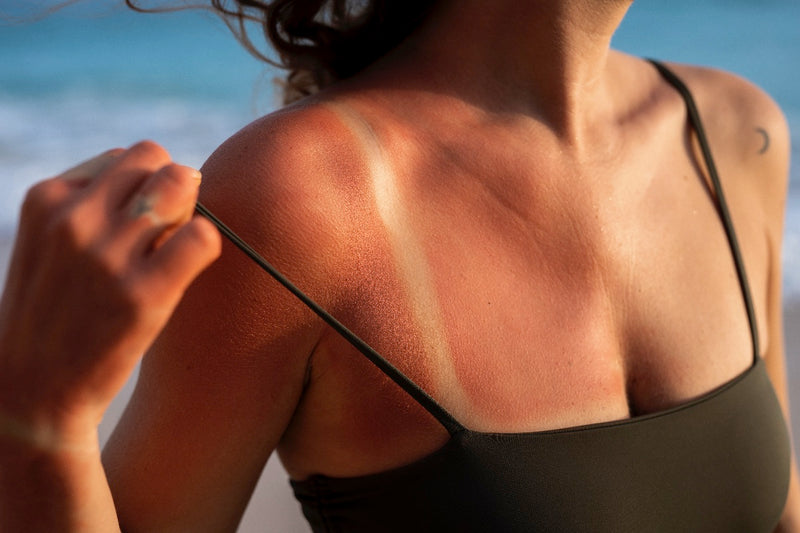 Does Skin Type Affect Exposure Time?